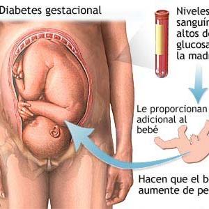 Type 2 Diabetes Causes - Fighting Discrimination Against Diabetes