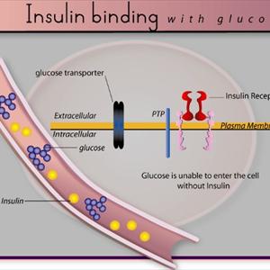 Type 2 Diabetes Nutrition - Get Information About Diabetes Types And Symptpms